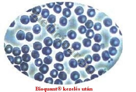 bioquant_kezeles_utan1.jpg bioquant_kezeles_utan1.jpg