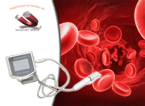 bioquant_lezerterapias_kezeles.jpg bioquant_lezerterapias_kezeles.jpg