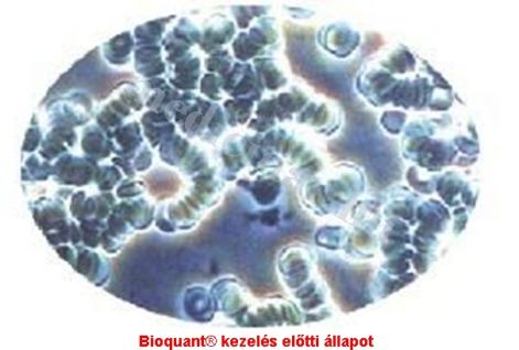 bioqunt_kezeles_elott.jpg bioqunt_kezeles_elott.jpg